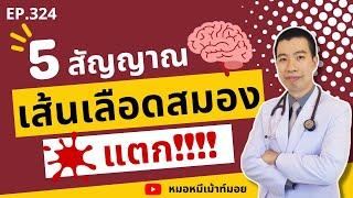 5 สัญญาณเตือนเส้นเลือดในสมองแตก | เม้าท์กับหมอหมี EP.324