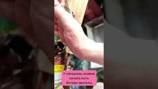 Истоки чистоты.#здоровье #экзема#экземарук#экземалечение#очищение#очищениекишечника#похудение