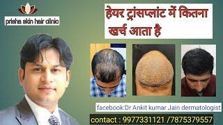 cost of hair transplant in india || prisha skin hair clinic || hair free hair grow || Dr Ankit Jain