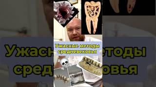 Как лечили зубы в средневековье ? #коронкиназубы #протезированиезубов #удалениезубов #стоматолог