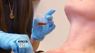 “The Perfect Derma Peel” Put to the Test