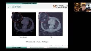 International Zoom Inverse Problems Seminar, Feb 18, 2021, Carola-Bibiane Schönlieb (Cambridge)