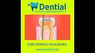 Dentista in Albania DENTIAL clinica odontoiatrica