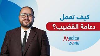 شاهد كيف تعمل دعامة القضيب | الدعامة الهيدروليكية | دكتور صلاح الهمشري | Medicazone