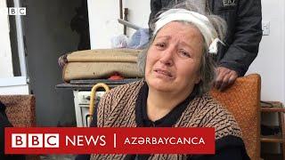 Yaralı Gəncə sakinləri danışırlar: “Gözlərim tam tutuldu, ayağım da yaralanıb, başım da”