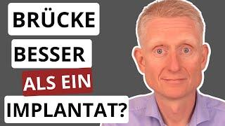 Wo ein Implantat richtig HÄSSLICH aussehen kann - Und Warum