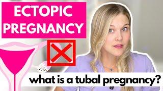 Ectopic and Tubal Pregnancy