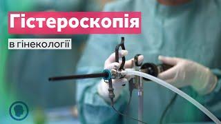 Гістероскопія в гінекології