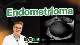 COMO RECONHECER O ENDOMETRIOMA NO ULTRASSOM? I VOCÊ RADIOLOGISTA