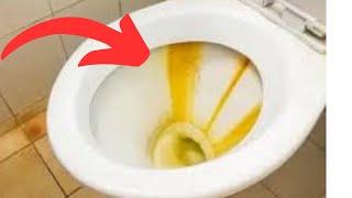 Make Yellowed Toilet Bowls and Yellowed Toilet Stones White - Whiten It in Just 2 Minutes