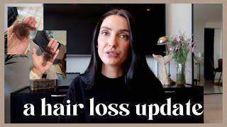 HAIR LOSS UPDATE | my hair loss journey with androgenetic alopecia | experience with oral minoxidil