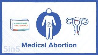 Medical Abortion