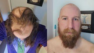 LONG HAIR To BALD in 20 Seconds TRANSFORMATION