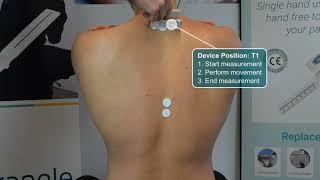 EasyAngle Spinal Measurements - Thoracic Rotation