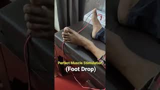 पैरों में लकवे का इलाज | How to apply Muscle stimulation in Foot Drop | Physio Dr Deepak Soni