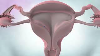 Cancers of the female reproductive system | Cancer Research UK