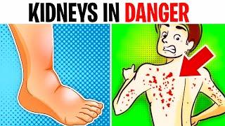 10 Signs Your KIDNEYS Are CRYING For Help