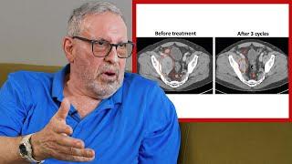 Testosterone & The Prostate Cancer Study | Jerry Brainum