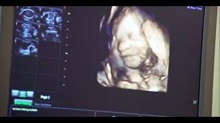 3D or 4D Scan (26 Weeks - 32 Weeks)