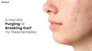 Is Your Skin Purging Or Breaking Out?