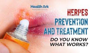 Effective HSV Prevention and Treatment: Your Complete Guide.