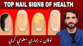 6 NAIL SIGNS of HEALTH PROBLEMS || Dr Adnan Khan