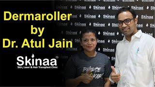 Dermaroller Treatment by Dr .Atul Jain | Skinaa Clinic