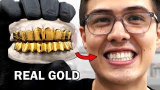 Making custom gold grillz (to avoid crippling embarrassment)