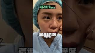 提眼肌手術是醫美整形手術中的難題#醫美診所 #醫美推薦 #台北醫美 #中壢醫美 #臻心美妍診所#臻心美妍#整形外科 #整形