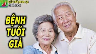 Bệnh tuổi già 5 bệnh hay gặp ở người cao tuổi và cách phòng ngừa