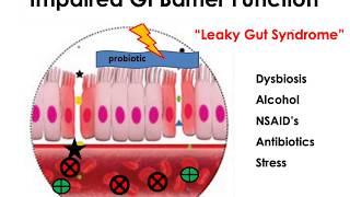 The Gut & Chronic Disease - Dr. Chris Link