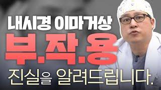 내시경 이마거상술 추천 대상과 부작용 솔직하게 알려드립니다.