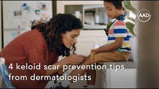 4 keloid scar prevention tips from dermatologists