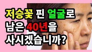 저승꽃(기미) 핀 얼굴로 남은 40년을 사시겠습니까? - 트라넥 글루타샷