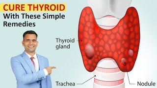 Easy Natural Treatment For Thyroid | Cure Thyroid with These Simple Remedies