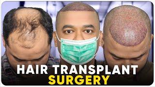 Hair Transplant in Bikaner | Best Results & Cost of Hair Transplant in Bikaner