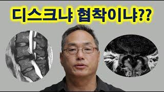 디스크냐 협착이냐