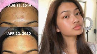 skincare routine 2020 // how i cleared my skin