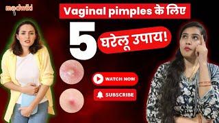 Vaginal boils/vaginal pimples का घर पर इलाज कैसे करें?Vaginal pimples से छुटकारा पाने के घरेलू उपाय!