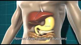 Diabetes and the body | Diabetes UK