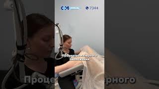 Интимное лазерное омоложение  #супрамед #гинекология #медицинскийцентр #минск