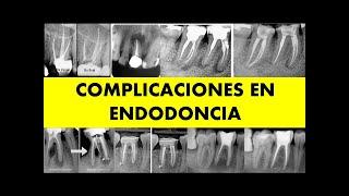 "COMPLICACIONES EN ENDODONCIA"