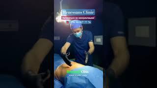 Dr.Choriyev #renessansclinic