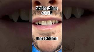 Schöne Zähne OHNE Schleifen - Flowable Injection by Dr. Boeddinghaus #veneers #schönezähne