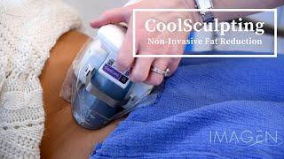 CoolSculpting for Fat Loss at Imagen Body Sculpting in Omaha, Nebraska