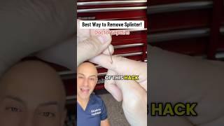 Doctor Explains SPLINTER HACK!