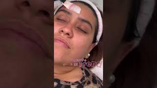 APRENDE LIMPIEZA FACIAL PROFUNDA CON APARATOLOGIA