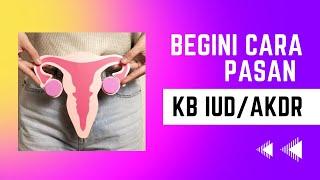 TERNYATA BEGINI CARA PASANG KB IUD