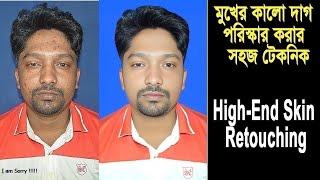 Pimples Remove In Photoshop । মুখের কালো দাগ পরিস্কার করার সঠিক নিয়ম ।#nuritechbangla#photoshop