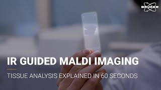 IR Guided MALDI Imaging in 60 seconds | Cancer Tissue Analysis Redefined